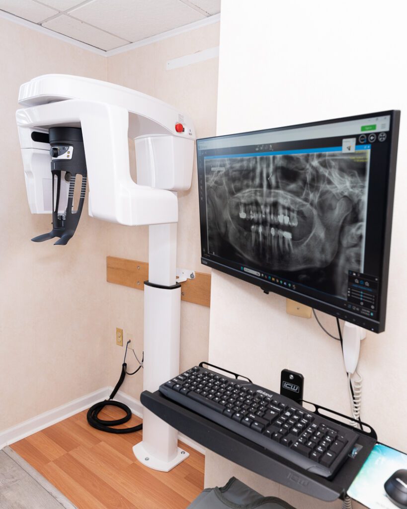 A 3-D dental scanner.